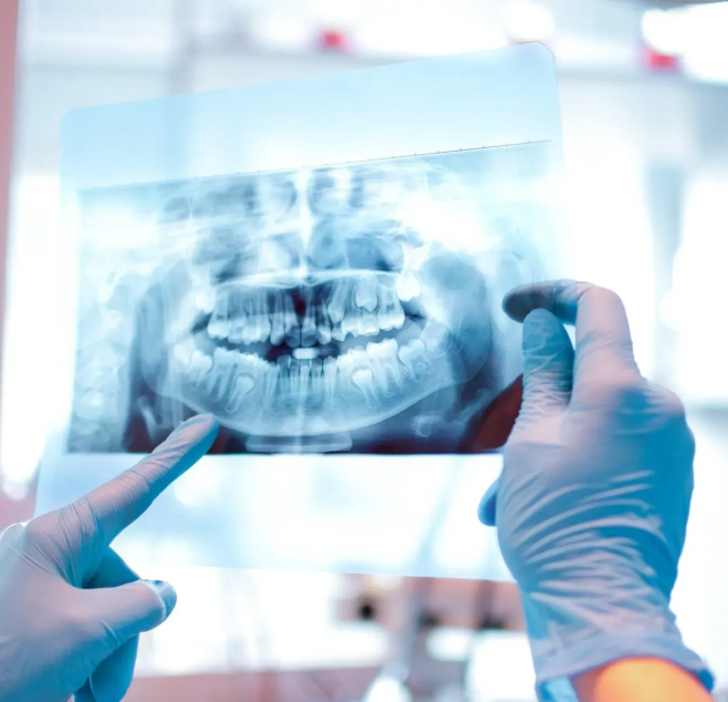 Bretagne Service Dentaire Materiel Dentaire Rennes Materiel D Imagerie Dentaire En 2D Et En 3D Intra Oral Extra Oral Camera
