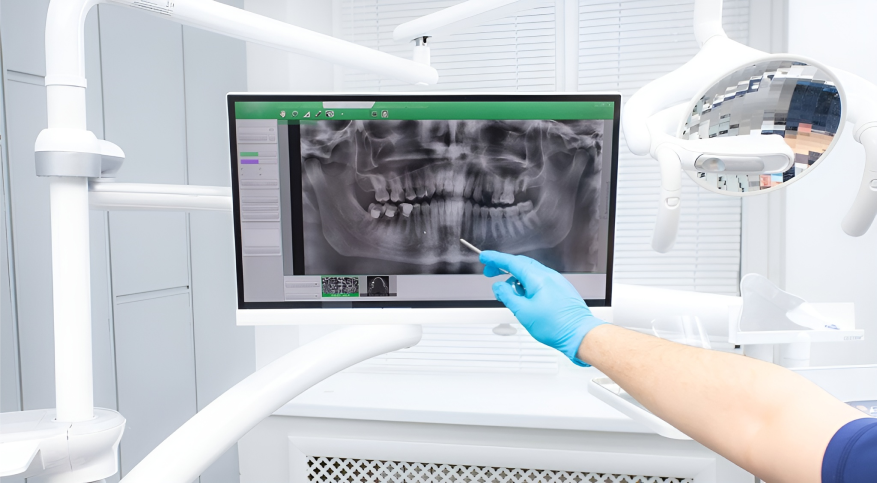 Bretagne Service Dentaire Materiel Dentaire Rennes Vente Et Installation De Systemes De Radiologie Imagerie Scanner Dentaire 1