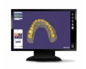 Bretagne Service Dentaire Materiel Dentaire Rennes Exocad Software 2058